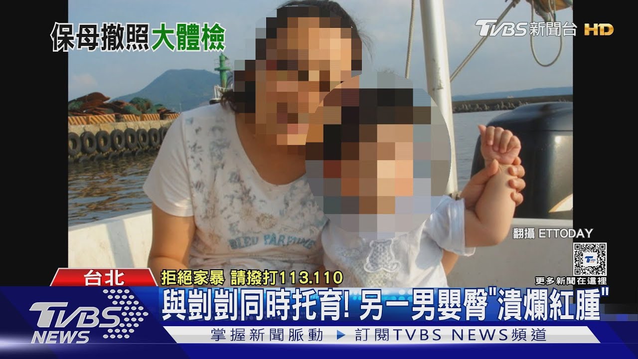 與凱凱同時托育！另一男嬰臀「潰爛紅腫」