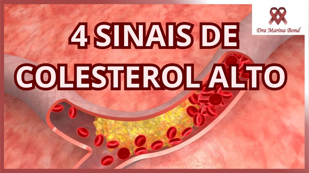 4 Sinais que seu corpo dá sobre COLESTEROL ALTO!