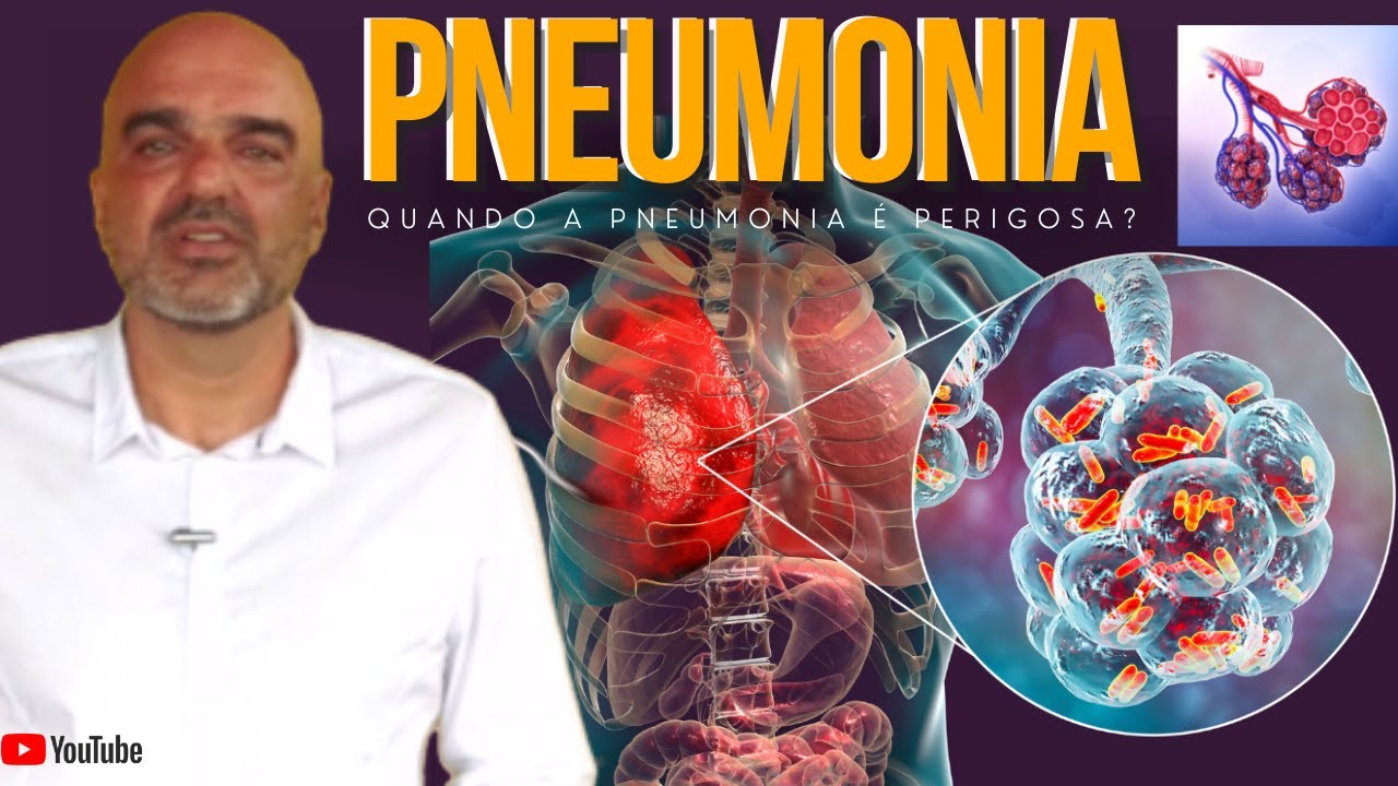 PNEUMONIA: o que é? Como é o começo da pneumonia? O que leva uma pessoa a ter pneumonia?