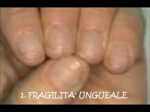 Mescolanza per il cibo di bambini con dermatite atopic Tsetrin allatto di risposte di dermatite atopic