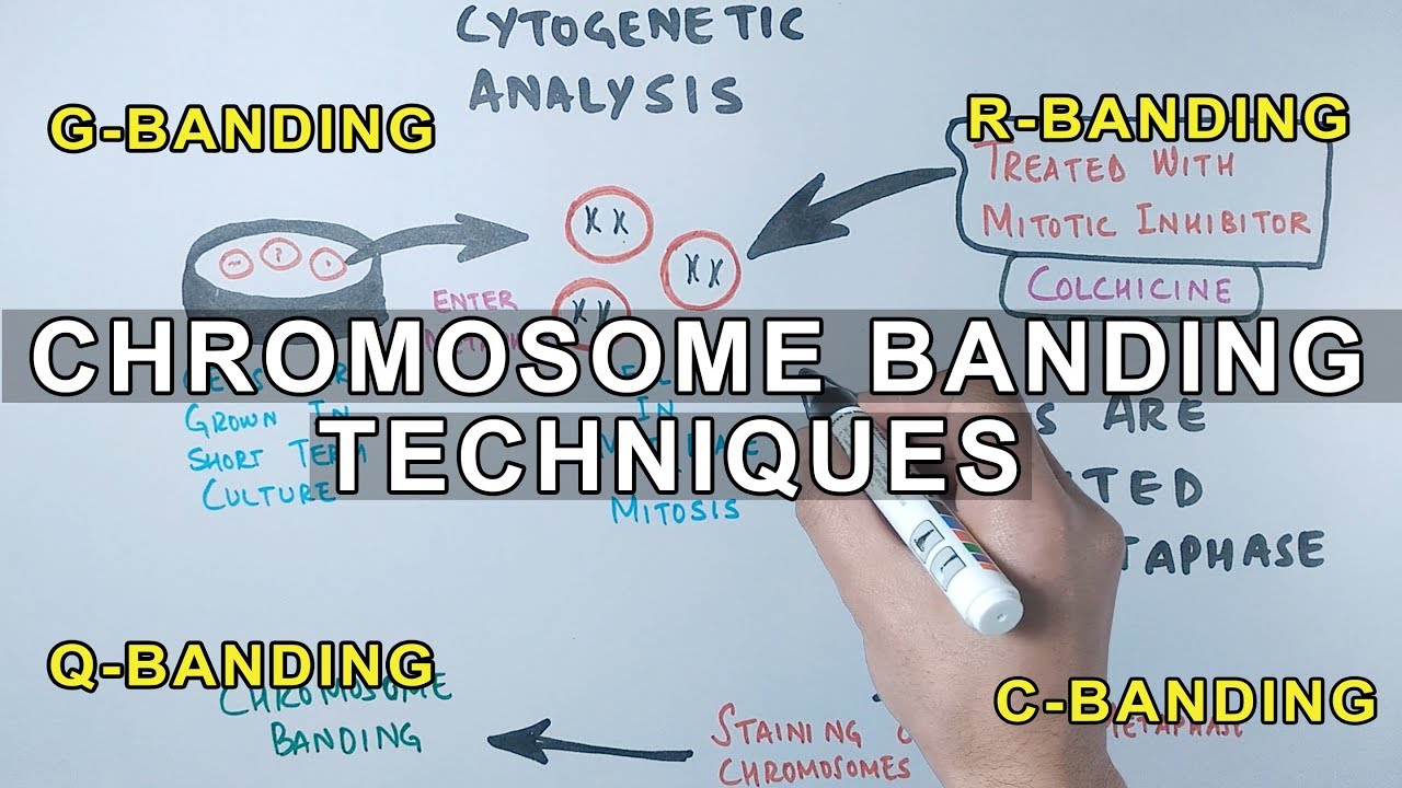 What causes the banding pattern on the chromosomes? Tipseri