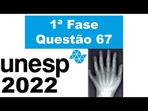 (Unesp 2022) A figura apresenta a radiografia da mão de uma menina portadora de polidactilia