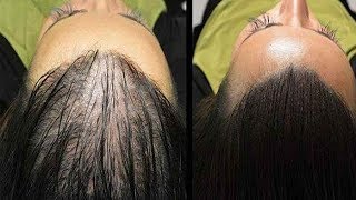 Magic Recipe For The Fastest Hair Growth Naturally