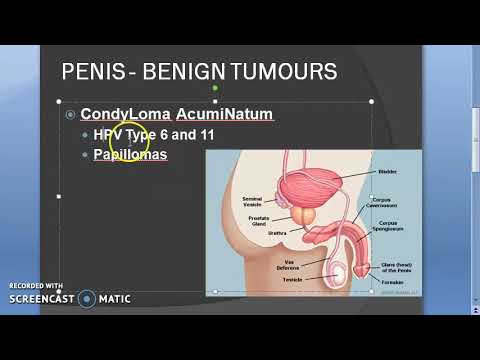 légzési papillomatosis dysplasia