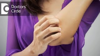 Causes of generalized itching without rash - Dr. Rashmi Ravindra
