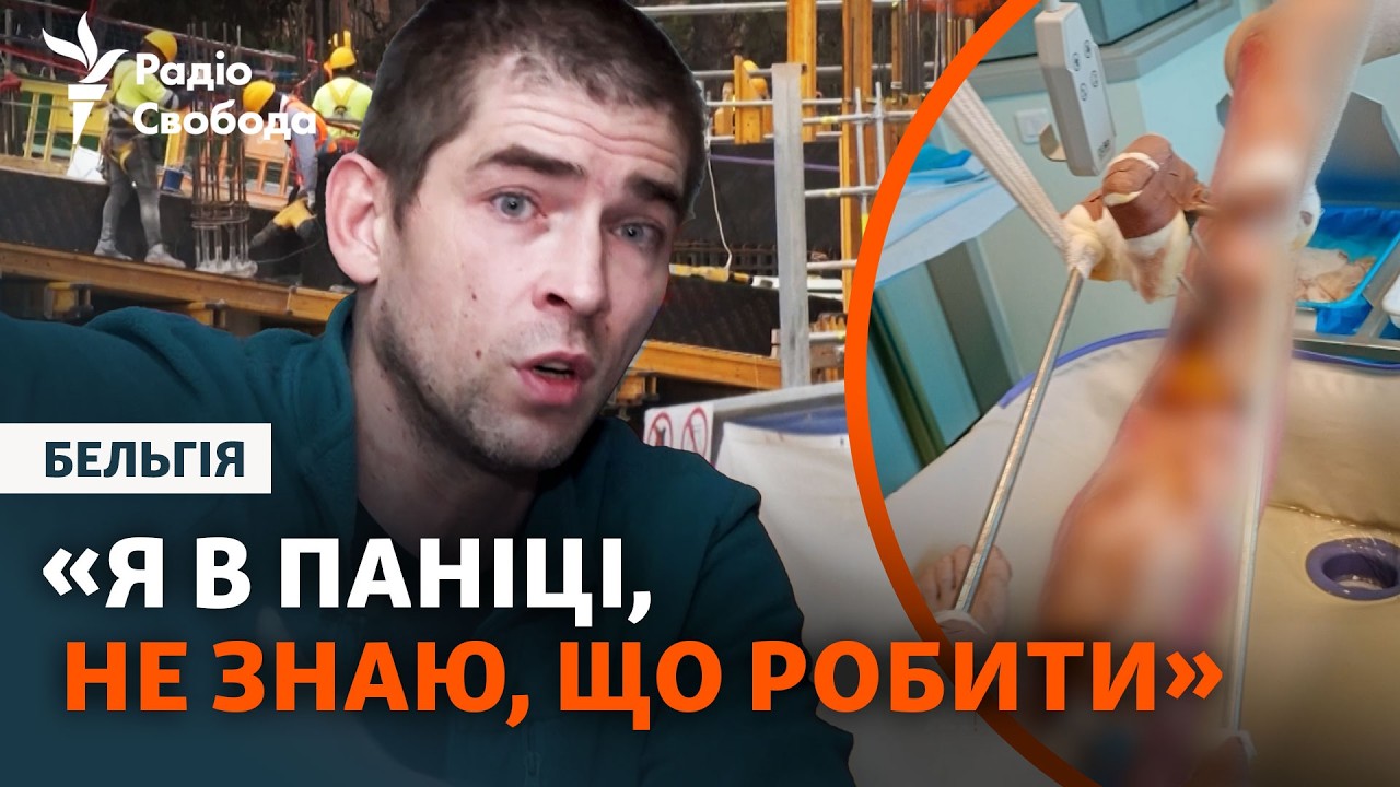 Українець втратив ногу на заробітках у Бельгії, тепер судиться з владою краї