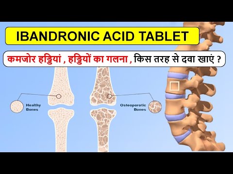50 Mg Ibandronic Acid Bandrone Tablet