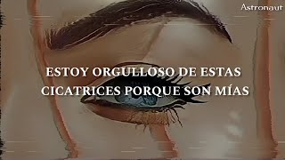 Written in the scars - The Script (sub español)