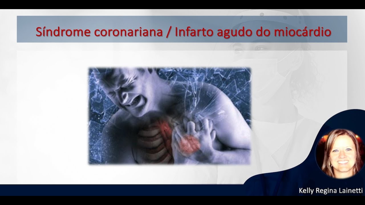 Síndrome Coronariana Aguda (SCA) / Infarto Agudo do Miocárdio (IAM)