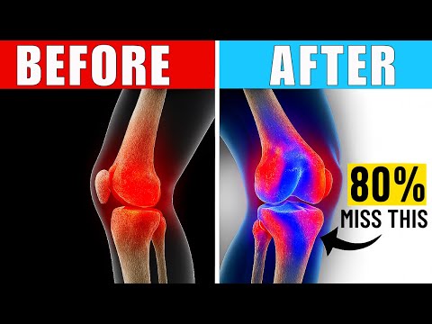 Critical Blood Test Every Lyme Disease Person Should Get