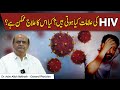 What Are The Signs And Symptoms Of HIV HIV Ka Ilaj Hai Ki Nahin