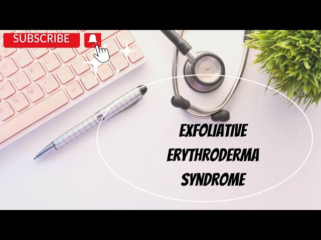 Videouttalande av erythroderma Engelska