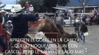preview picture of video 'ARVEY PEREZ EN EL BALCON SE GOLPEO LA CABEZA'