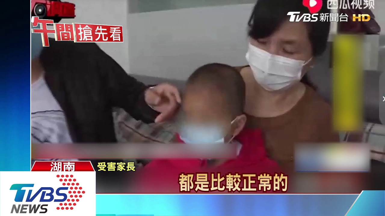 湖南又見大頭娃娃　顱骨變形不自覺拍頭