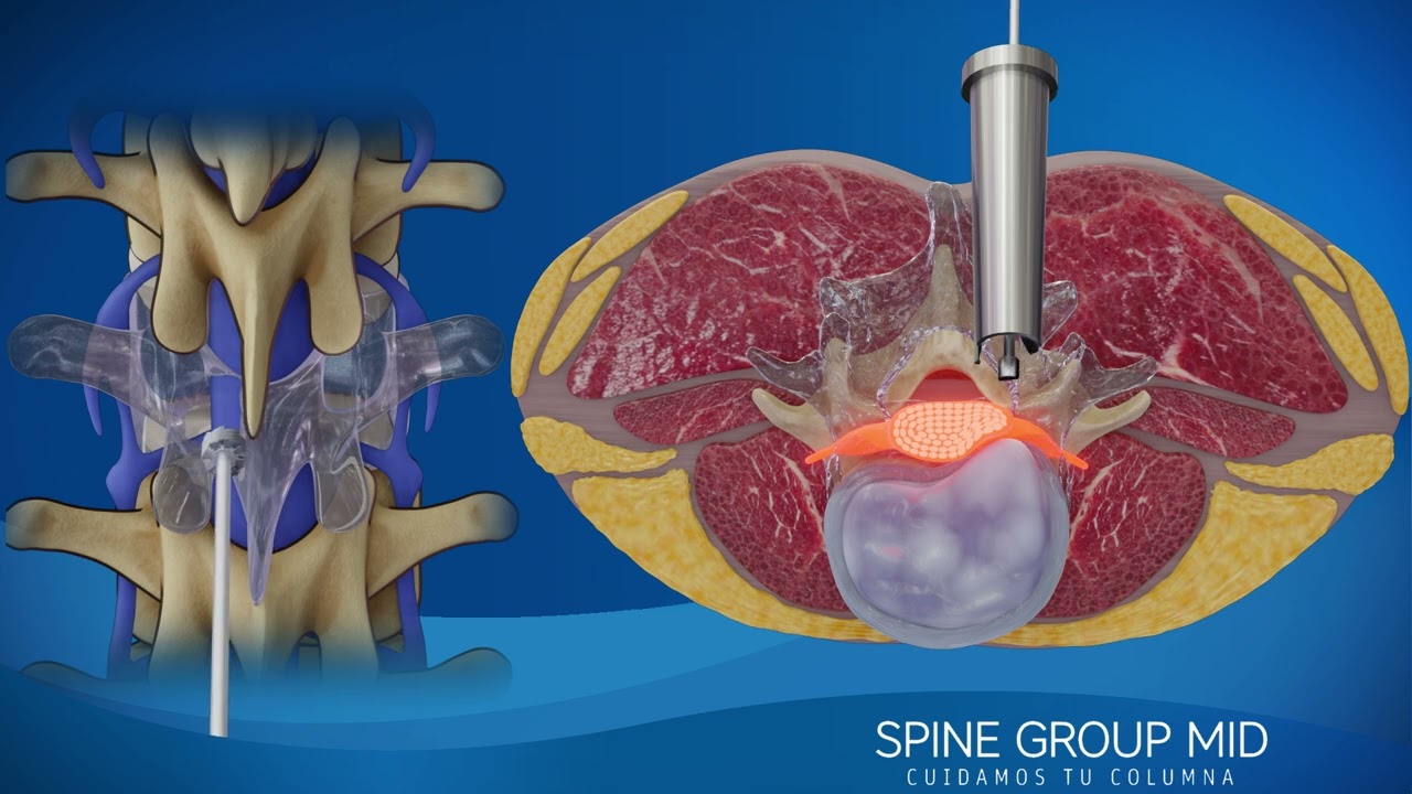 Alejandro Carlos Audiffred Mayoral-10