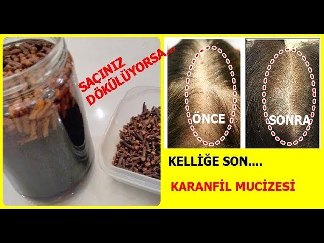 Video Aussprache von Karanfil in Türkisch