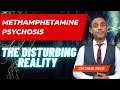 The Devastating Reality of Methamphetamine Psychosis: A Warning