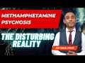 The Devastating Reality Of Methamphetamine Psychosis A Warning