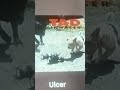 Seattle SABBATICAL 🌿 TAD /"Ulcer"