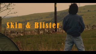 SKIN & BLISTER | Short Film