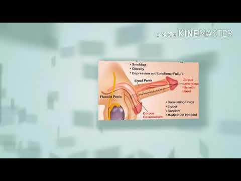 Proliferative Stadium der Prostatitis Prostatamassage Trainingsvideos