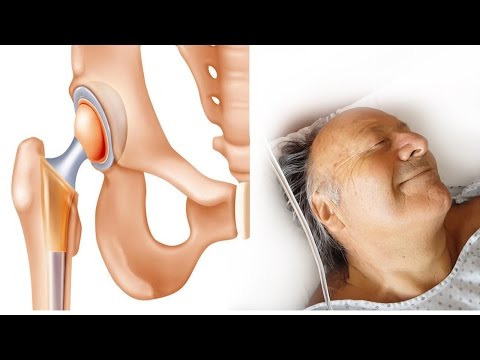 Osteocondrosi delle cause di lombari Asse comune di rotazione