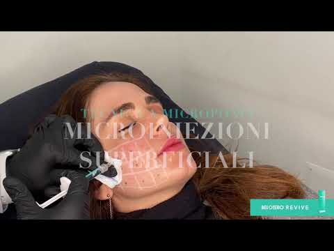 Biorivitalizzazione viso Dr Lips — guarda il video
