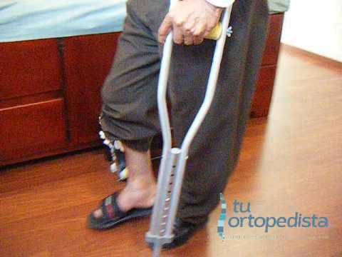 Cum se poate vindeca artroza și artrita genunchiului