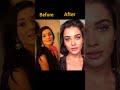 Amy Jackson Plastic Surgery Looks Viral Youtubeshorts Shorts Bollywood Actress Amyjackson