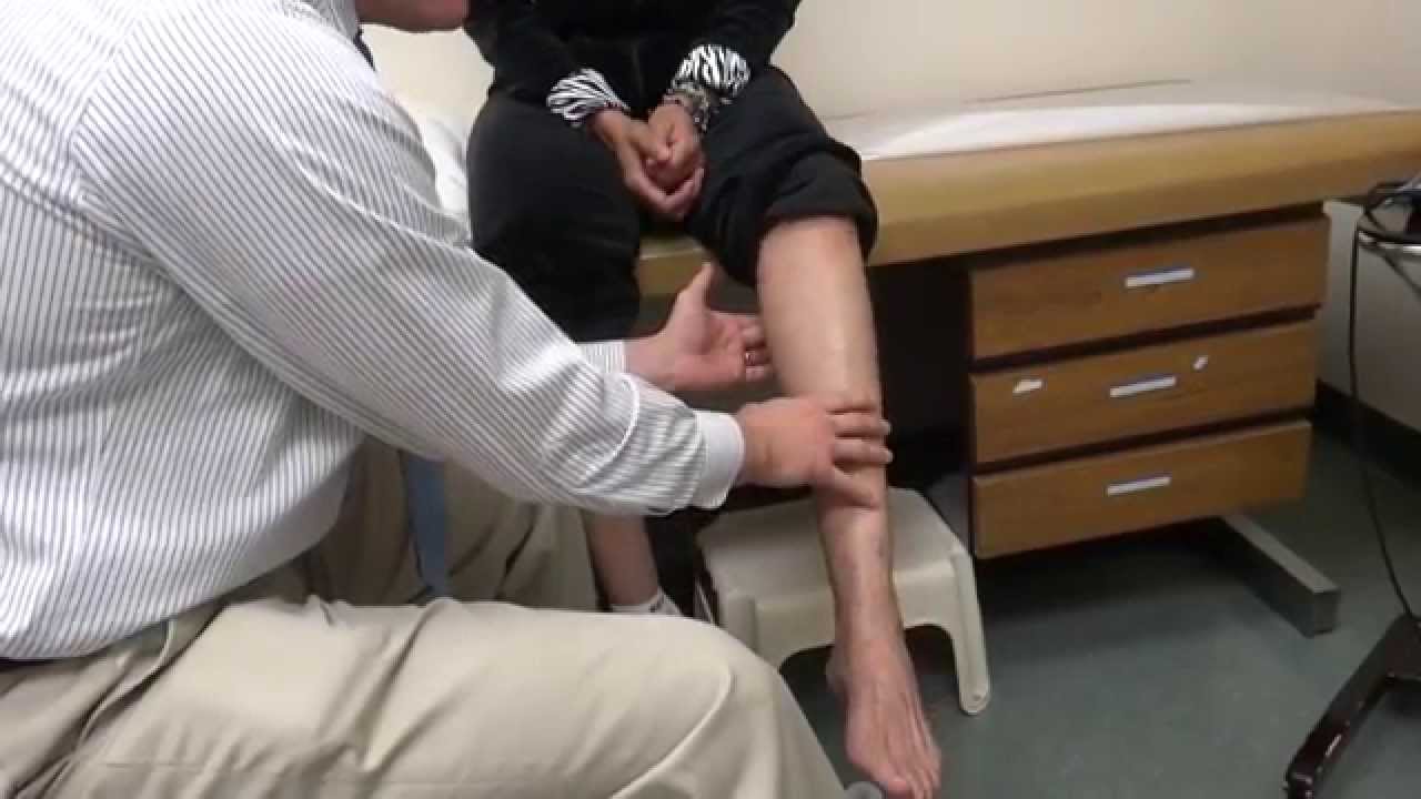 4 Months After Decompression of the Proximal Tibial Nerve