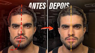 How to fix FACIAL ASYMMETRY. Practical exercises.