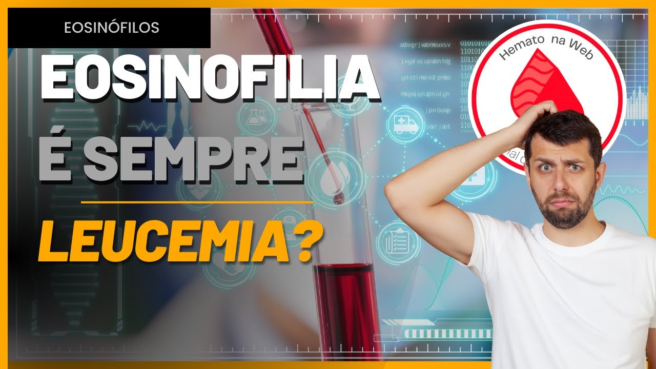 EOSINÓFILOS [eosinofilia] altos no HEMOGRAMA, o que significa? | Geydson Cruz [MD,Msc]