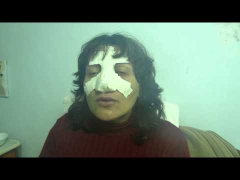 Призив към Община Добрич да се осигури охрана на опасно място в града