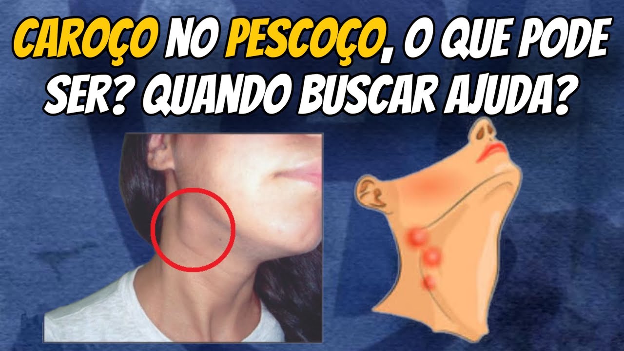 Francisco De Assis Almeida Lima Júnior-43