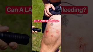 Can a LASER Stop My Bleeding? #shorts #funny #science