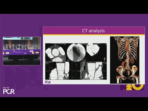 Optimising self-expandable TAVI clinical outcomes without compromise - EuroPCR 2025
