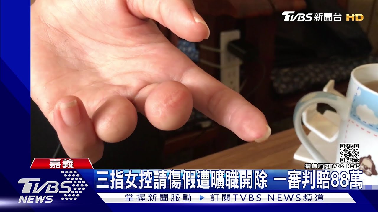三指女怒控請假遭曠職開除 一審判公司賠88萬元