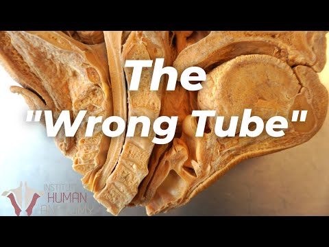 , title : 'How BAD Is It When Something Goes Down the "Wrong Tube"???'