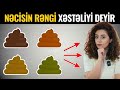 Nəcisin Rənginə Baxın Xəstəliyinizi Biləcəksiz