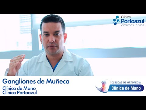 Gangliones de Muñeca