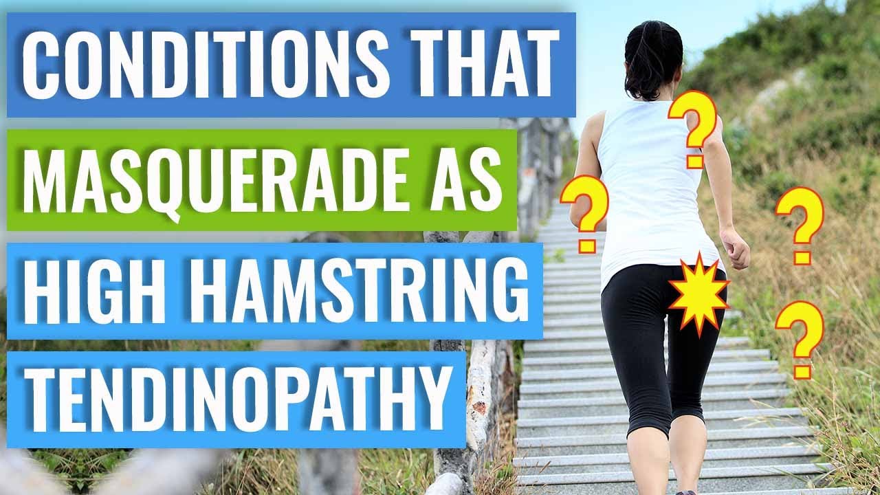 Conditions that Masquerade as High Hamstring Tendinopathy