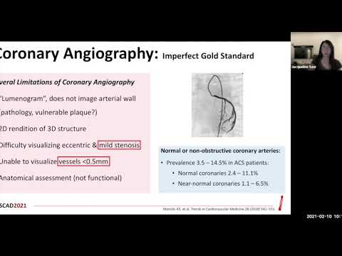 Dr. Saw - Using AI to diagnose Spontaneous Coronary Artery Dissection on Coronary Angiography