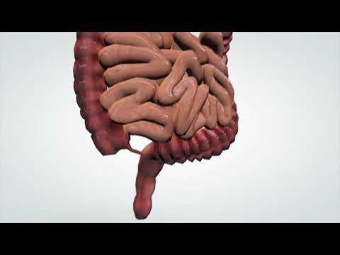 Što je fenilketonurija?