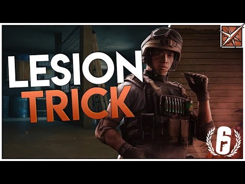 Check Out This Lesion Trick! | Rainbow Six Siege