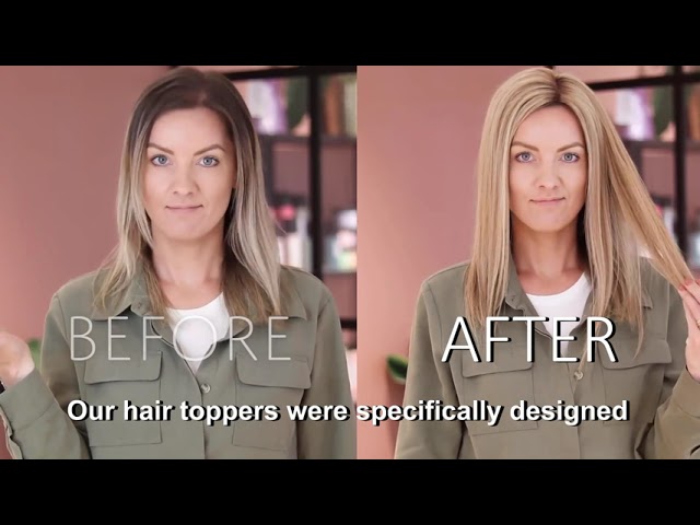 الشرقية حبيبي ترشيح صوف تتفق يمكن hair toppers before and after - الشرقية حبيبي ترشيح صوف تتفق يمكن hair toppers before and after -