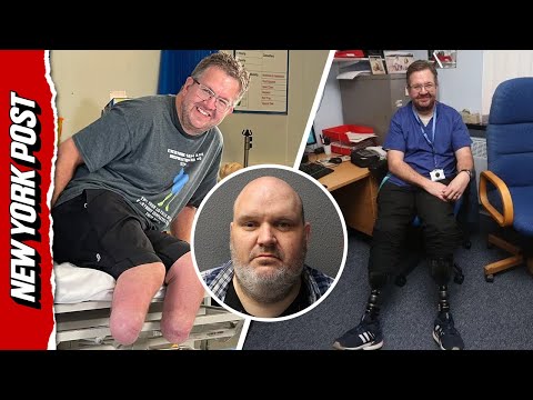 Surgeon accused of LYING about why he had to amputate his own legs after $680,000 insurance claim