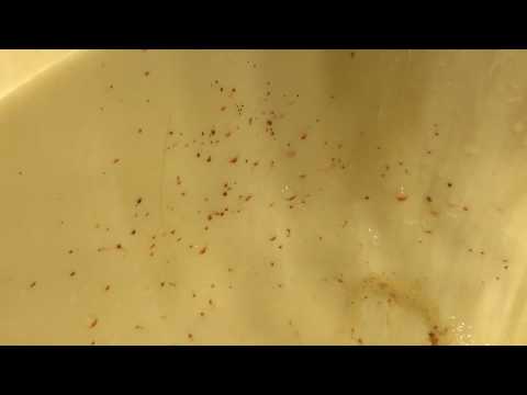 How to get rid of fleas: combed fleas vomit their sucked blood