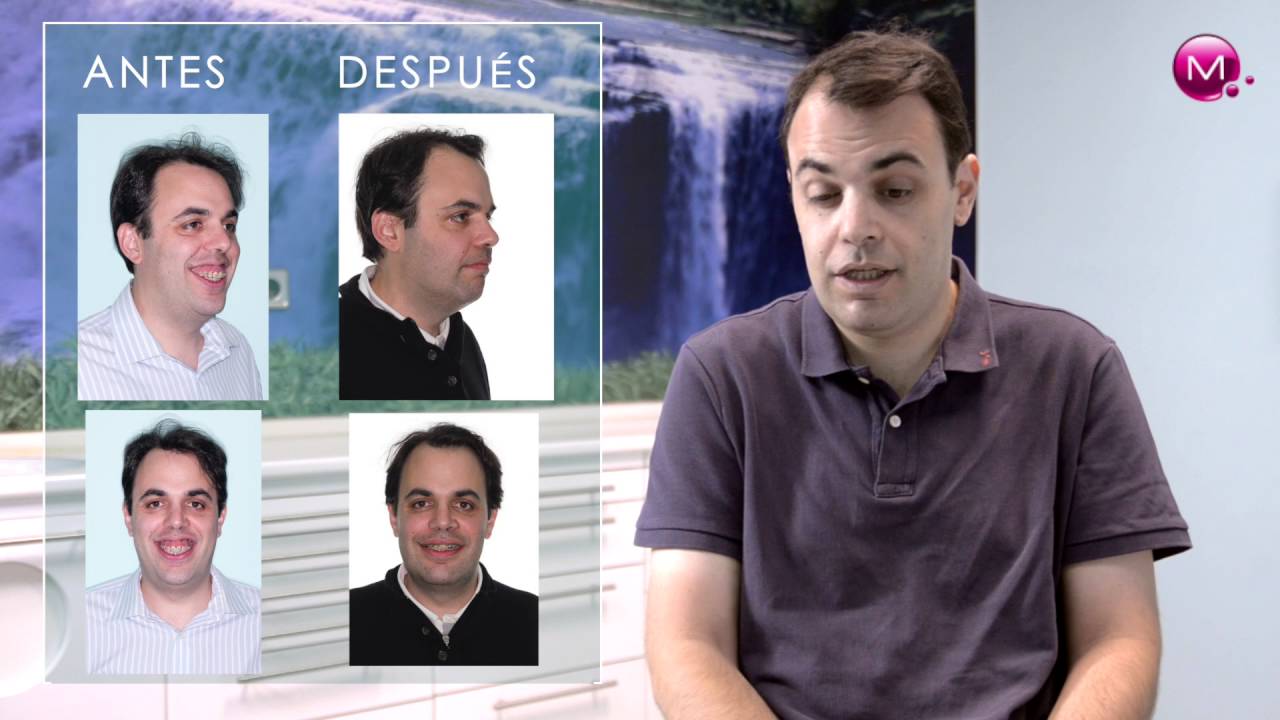 Jorge Calvo De Mora-31