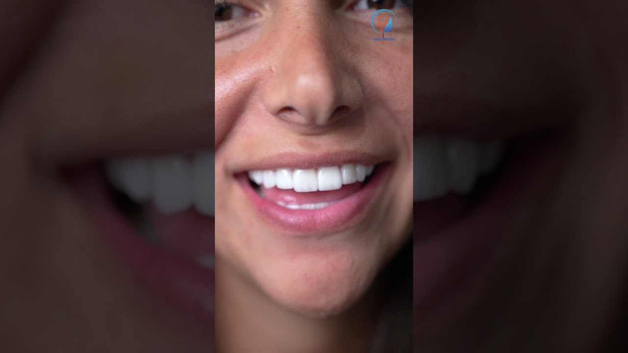 Video 5