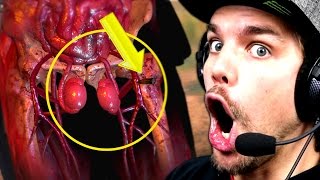 TIR DANS LES TESTICULES Sniper Elite 4 